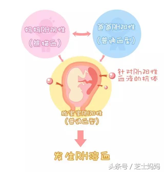 朋友圈熊猫血,熊猫血生娃需要关注什么