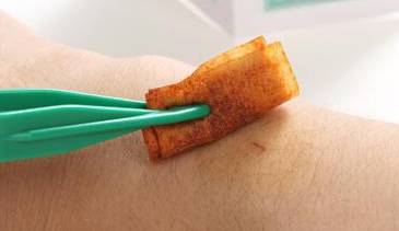 柳州一5岁孩子被小伙伴咬伤胸口，家长要求打狂犬疫苗！