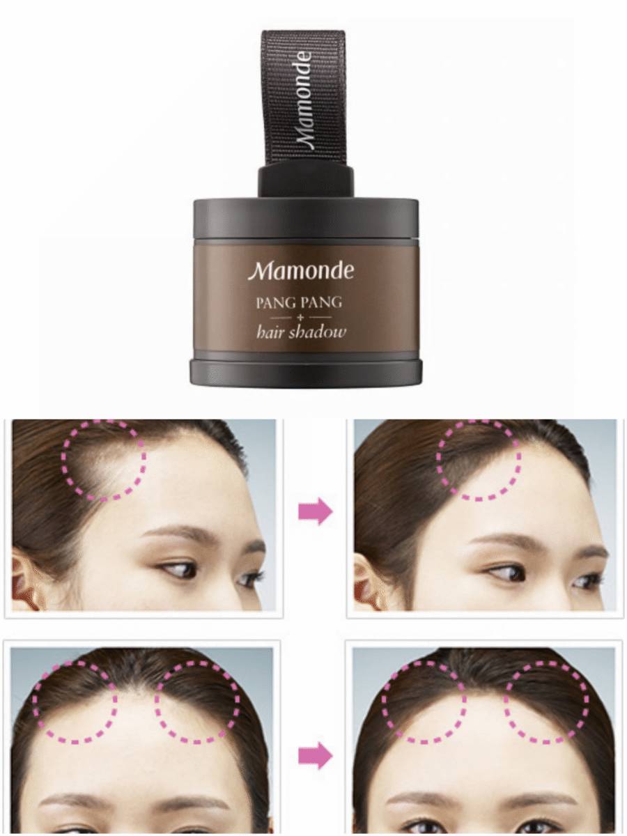 我的发际线我该拿什么拯救你,拿什么拯救你我的发际线