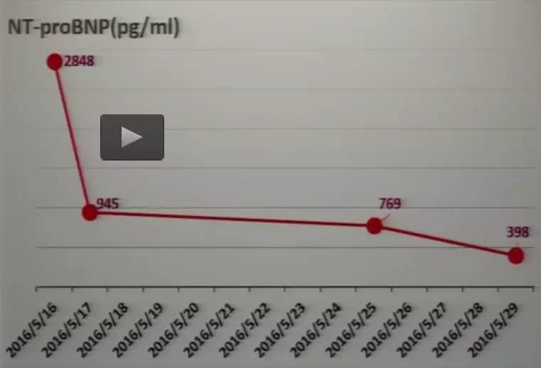 心脏增大引发的心衰能治好吗,急性心衰引起心脏扩大能治愈吗