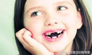 孩子满口的蛀牙怎么治疗,小小年纪牙齿全坏了怎么办