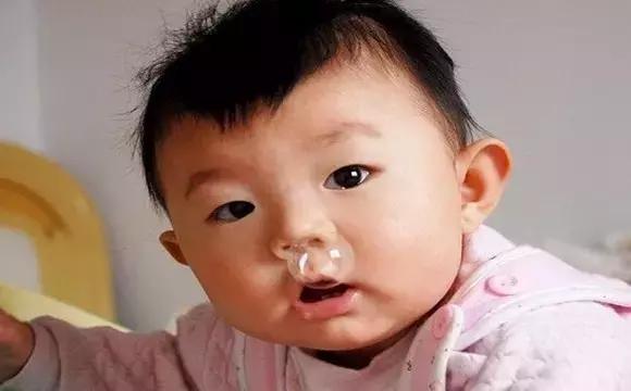 小孩老是有黄鼻涕是鼻炎吗,小孩流黄鼻涕是鼻窦炎吗