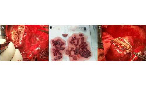 视线模糊吃什么中药,视线模糊吃什么中成药好