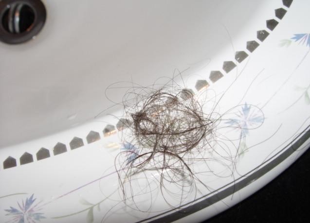 为什么现在的人脱发掉发严重,为什么年轻人老是掉头发