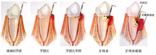 孕期如何预防胎儿疾病,孕期病发症怎么避免