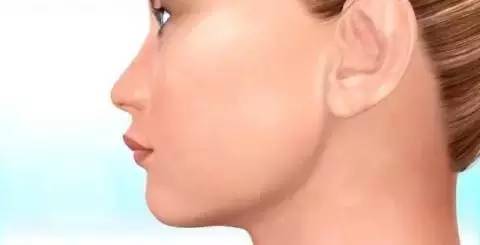 如何一秒钟矫正牙齿,牙齿矫正让你悄然改变从现在开始