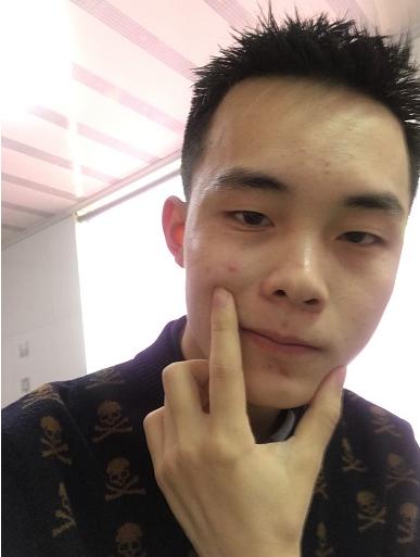 熬夜通宵加班脸上长痘,熬夜加班受不了了