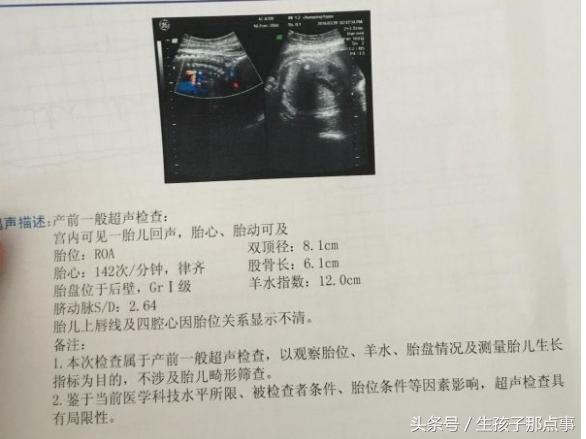 专家分享b超单的奥秘,b超单上的100个小秘密