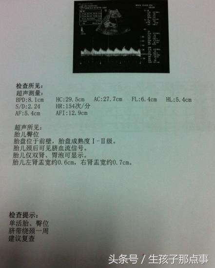 专家分享b超单的奥秘,b超单上的100个小秘密