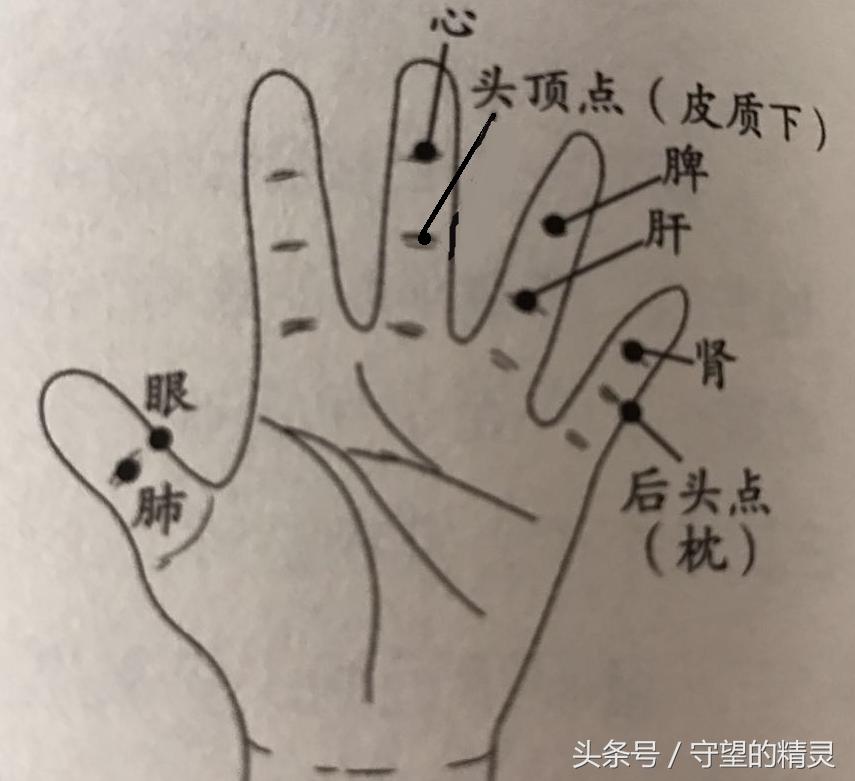 中医推拿能调理近视吗,李氏推拿手法治疗近视