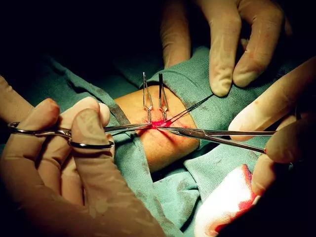 信中医被治成尿毒症,信农村偏方的后果