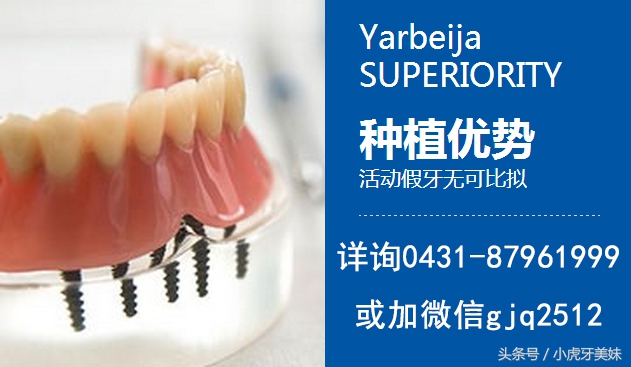 老年人适合的镶牙种类和价格,老年人镶牙选哪种牙比较靠谱