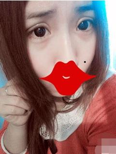 长期用双眼皮胶水变松,长期用胶水粘双眼皮的后果