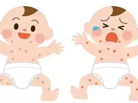 婴儿耳朵长湿疹的原因和解决办法,睡觉湿疹了有什么解决的好办法