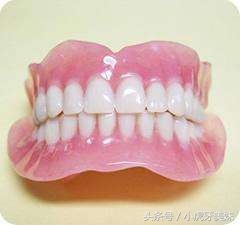 老年人适合的镶牙种类和价格,老年人镶牙选哪种牙比较靠谱