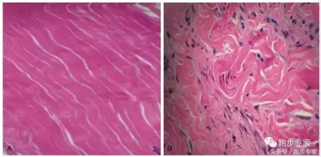 跑者小腿疼痛如何解决,跑后脚痛如何做恢复训练