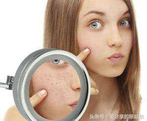 烫伤后毛孔变大会恢复正常吗,毛孔变大了还有没有办法修复