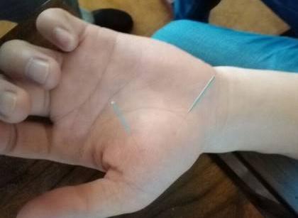 治背疼痛的穴位,董氏奇穴治疗后背疼的视频