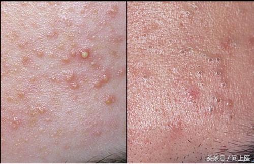 人常见的皮肤病,十二种最常见的皮肤问题对照图