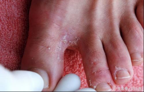 人常见的皮肤病,十二种最常见的皮肤问题对照图