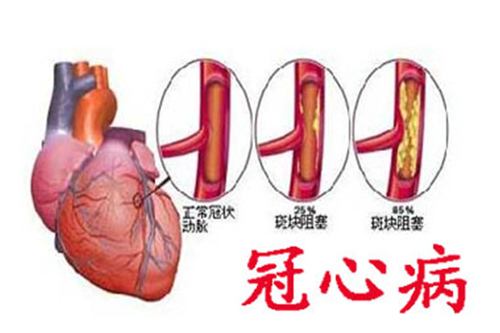 她因冠心病去医院，结果痛经却治好了，这意外收获是咋回事？