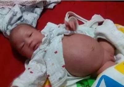 宝宝8天没拉粑粑怎么办,宝宝7-8天不拉粑粑怎么办