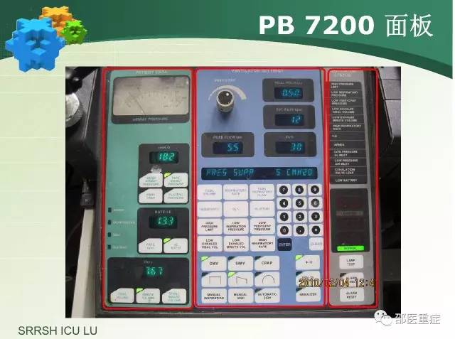 有创机械通气操作,机械通气英文缩写