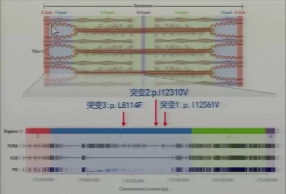 心脏增大引发的心衰能治好吗,急性心衰引起心脏扩大能治愈吗