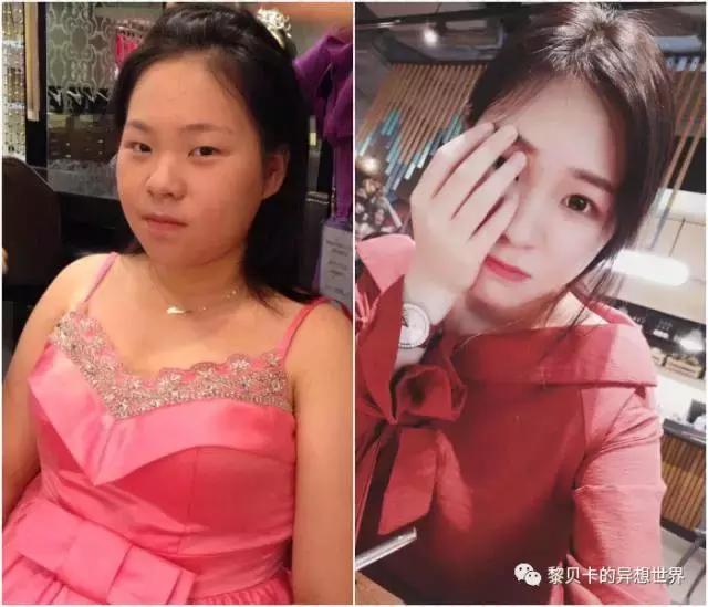 成功甩掉100斤赘肉,甩掉赘肉最快的方法