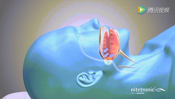 德国黑科技治疗打呼噜的枕头测评,德国枕头治疗打鼾