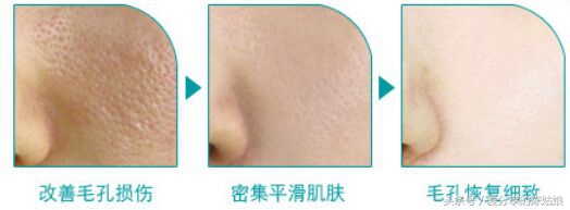 烫伤后毛孔变大会恢复正常吗,毛孔变大了还有没有办法修复