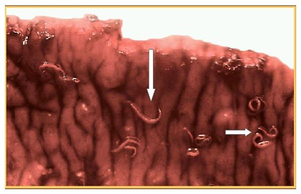 身体有这些症状要关注,肚子里有寄生虫的症状吃什么药