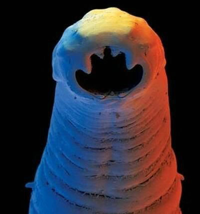 身体有这些症状要关注,肚子里有寄生虫的症状吃什么药