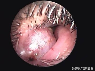 鼻子一直不通气是为什么,鼻子总不通气怎么治