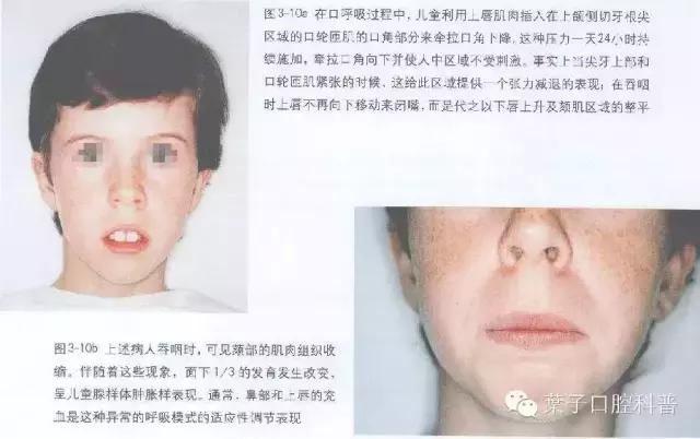 是谁将孩子推入网络深渊,是谁把宝宝推下了台阶