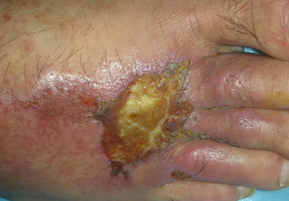 身体有这些症状要关注,肚子里有寄生虫的症状吃什么药