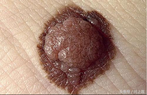 人常见的皮肤病,十二种最常见的皮肤问题对照图