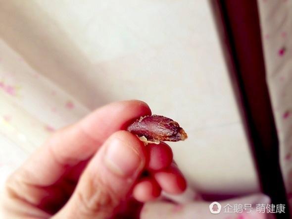 小孩误吞枣核刺破异物,食道中有异物如枣核怎么取出