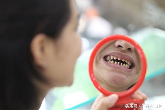 烤瓷牙牙基烂没了怎么办,烤瓷牙会变形状吗