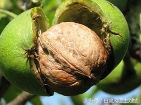 这么多年都吃错了？核桃不能补脑，但能治白癜风！