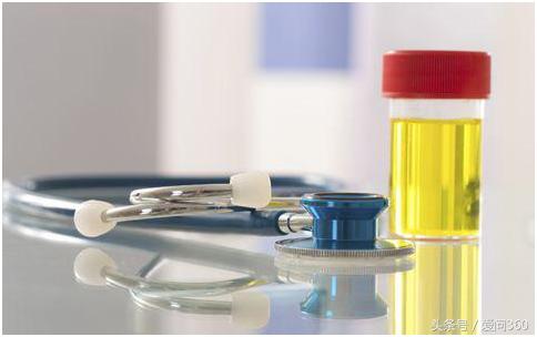 尿液发黄是不是有疾病,男性尿液腥臭发黄有泡沫