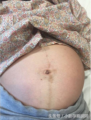 分娩催产日记,分娩日记100篇