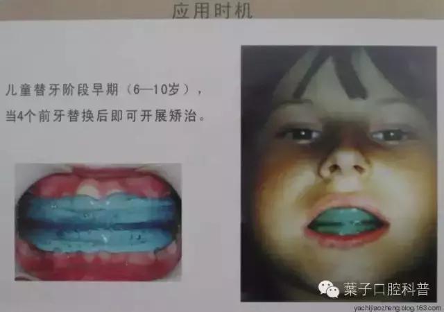 是谁将孩子推入网络深渊,是谁把宝宝推下了台阶