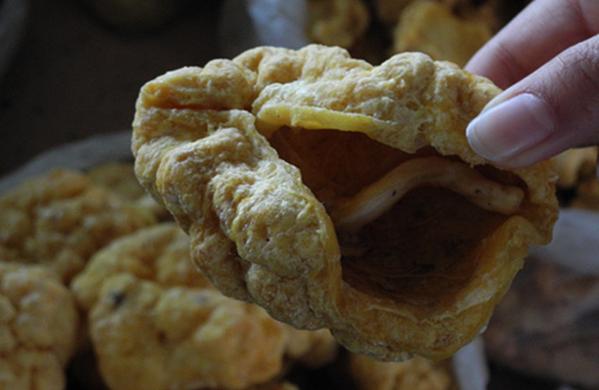 胎盘长什么样,胎盘植入你了解吗