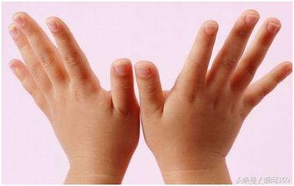 手上长湿疹因为湿气重吗,手上突然长湿疹怎么办