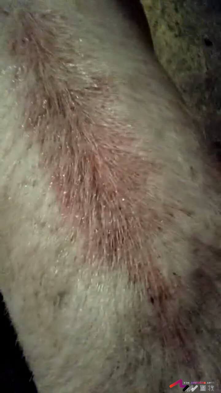 背部伤口流血,背部细菌性感染