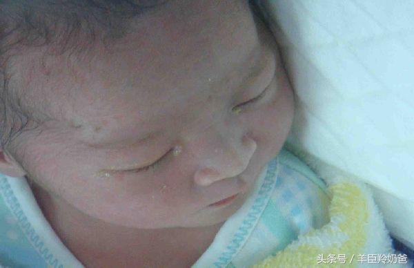 新生儿眼屎多且黄还粘稠的原因,新生儿眼屎多又黄又浓稠怎么解决