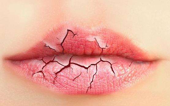 这个尴尬的季节来啦！各位干皮、混干皮的美娃娃们又该开始烦恼了