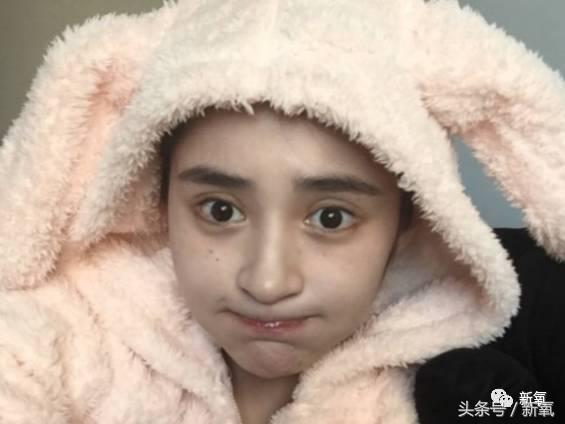 为什么开眼角会变漂亮,为什么开眼角很奇怪