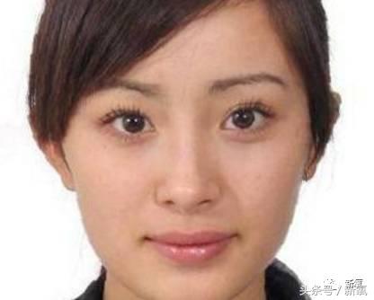 为什么开眼角会变漂亮,为什么开眼角很奇怪